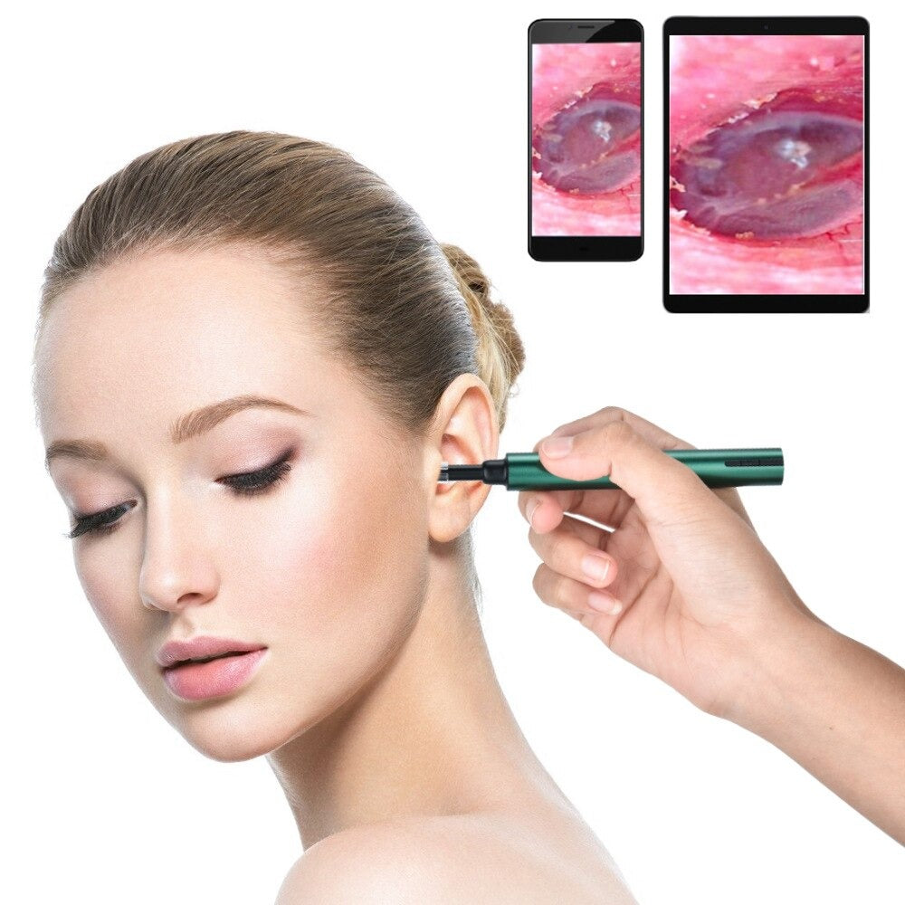 Otoscope Ear Wax Remover